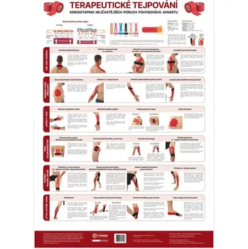 Plakát Anatomický plakát - Terapeutické tejpování 48 x 70 cm