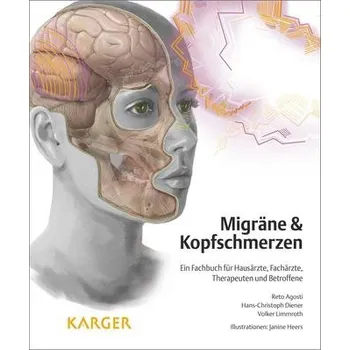 Migräne & Kopfschmerzen - Agosti, Reto
