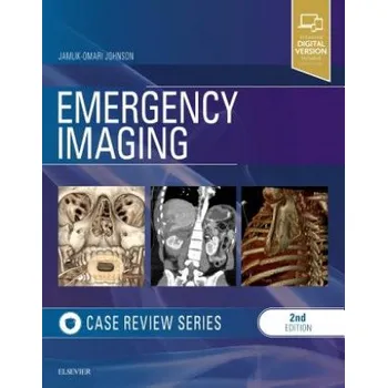 Emergency Imaging: Case Review Series – Jamlik-Omari Johnson (EN)
