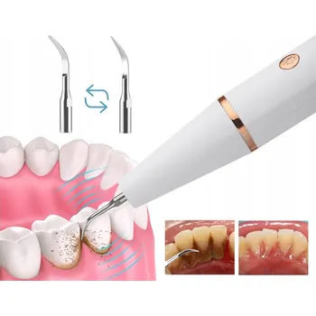 Elektrický zubní kartáček ULTRAZVUKOVÝ ZUBNÍ SKALER NA ČIŠTĚNÍ ZUBŮ - 3 REŽIMY