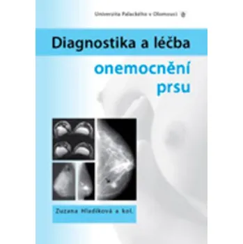 Diagnostika a léčba onemocnění prsu - Zuzana Hladíková