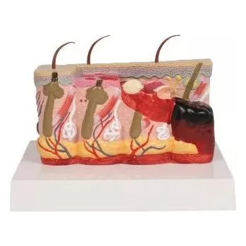 Patologický model kůže s popáleninami, 30x větší