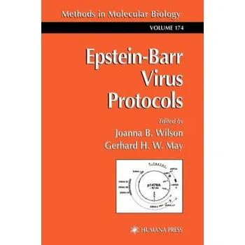 Epstein-Barr Virus Protocols – Joanna B. Wilson,Gerhard H. W. May (EN)