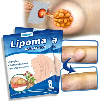 Náplast Očistná náplast ZB Lipoma na lipomy (tukové bulky) 6 ks