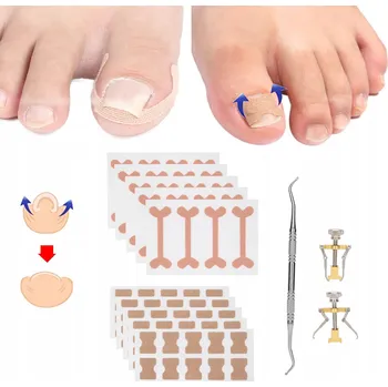 Pružinka na zarůstající nehty 13 sad