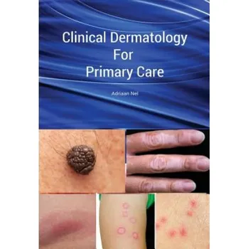 Clinical Dermatology For Primary Care (Adriaan Nel)(Brožovaná)
