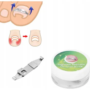 Obraz Spona na zarůstající nehty