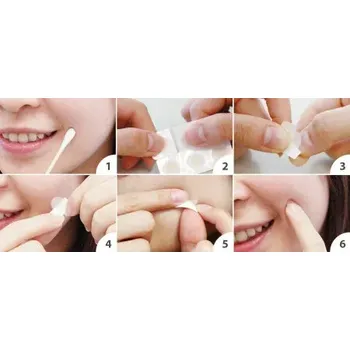 Léčba akné Náplasti na akné 12 ks