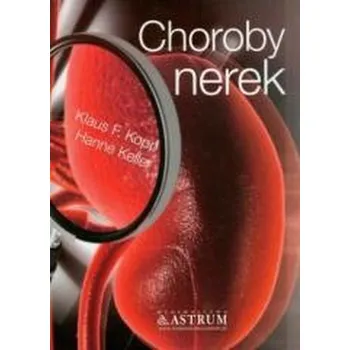 Choroby nerek - Kopp Klaus F., Keller Hanne [PL] (1997, Brožovaná, Astrum)