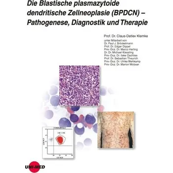 Die Blastische plasmazytoide dendritische Zellneoplasie (BPDCN) - Pathogenese, Diagnostik und Therapie - Klemke, Claus-Detlev