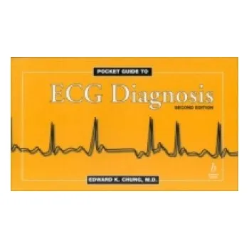 Pocket Guide to ECG Diagnosis – Edward K. Chung (EN)