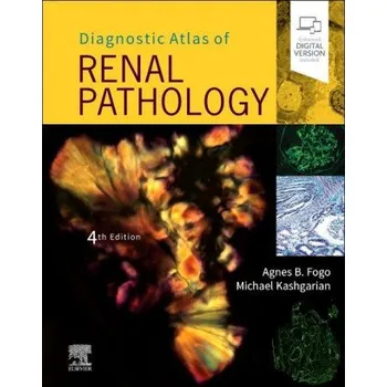 Diagnostic Atlas of Renal Pathology (Agnes B. Fogo,Michael Kashgarian)(Pevná)