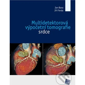Kniha Multidetektorová výpočetní tomografie srdce - Jan Baxa, Jiří Ferda Galén