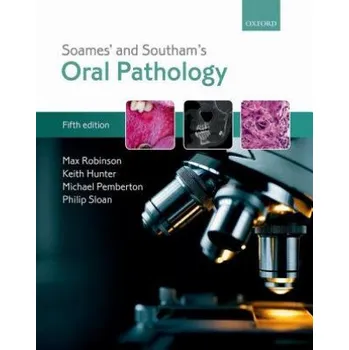 Soames' & Southam's Oral Pathology – Robinson,Max (Senior Lecturer in Oral Pathology,School of Dental Science,Newcastle University,UK),Hunter,Keith (Professor of Head and Neck Patho (EN)