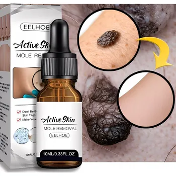 Příslušenství k vrtačce ROZTOK NA ODSTRANĚNÍ ZNÁMEK A BRADAVIC NA KŮŽI BEZ JIZEV BEZBOLESTNÝ SNADNÝ