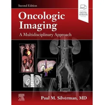 Oncologic Imaging: A Multidisciplinary Approach (Paul Silverman)(Pevná)