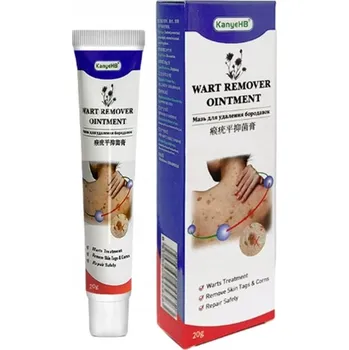 Krém na odstranění bradavic a kožních výrůstků, jemný antibakteriální