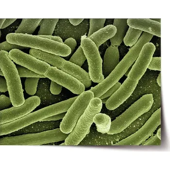 Plakát Sablio Plakát Bakterie - 120x80 cm