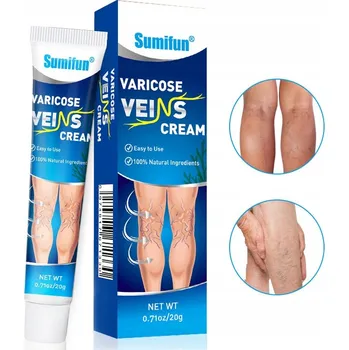 Krém na křečové žíly Účinný na zánět cév Zánět žil Metličkové žilky Mast na křečové žíly
