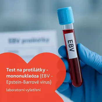 Diagnostický test Test na protilátky - mononukleóza laboratorní vyšetření