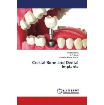 Crestal Bone and Dental Implants – Nivedita Bawa,S. P. Singh,Chandan Kumar Kusum (EN)
