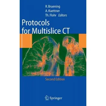 Cizojazyčná kniha Protocols for Multislice CT – Brüning (EN)