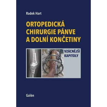 Ortopedická chirurgie pánve a dolní končetiny - Radek Hart - 978-80-7492-611-2