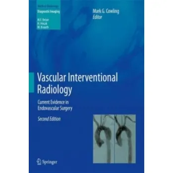 Vascular Interventional Radiology: Current Evidence in Endovascular Surgery – Mark G. Cowling (EN)