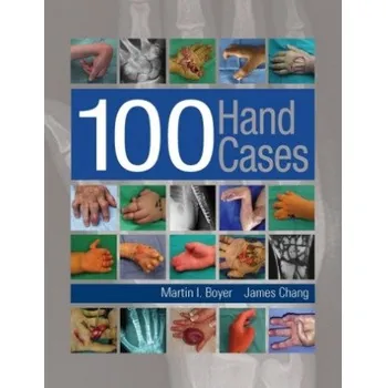 100 Hand Cases (Martin I. Boyer,James Chang)(Pevná)