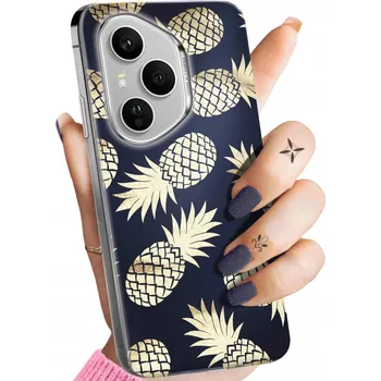 Pouzdro na mobilní telefon Zadní Kryt Hello Case pro Honor 400 Pro zlatý