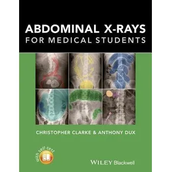 Abdominal X-rays for Medical Students - Clarke, Christopher (Nottingham University Hospitals) a Dux, Anthony (University Hospitals of Leicester)