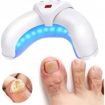 Zabezpečení domácnosti Laserové zařízení pro léčbu plísně nehtů - Bezbolestné a účinné