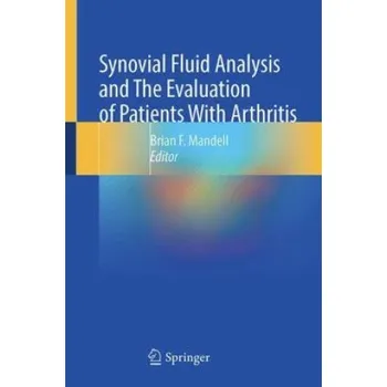 Cizojazyčná kniha Synovial Fluid Analysis and The Evaluation of Patients With Arthritis (Brian F. Mandell)(Pevná)