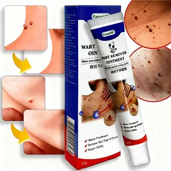 KRÉM MAST NA ODSTRANĚNÍ BRADAVIC, KONDYLOMAT A ZNÁMEK BEZPEČNÝ 20G