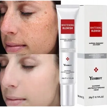 Pleťový krém Bělící krém na pihy účinný, odstraňte krém Melasma, odstraňte tmavé skvrny