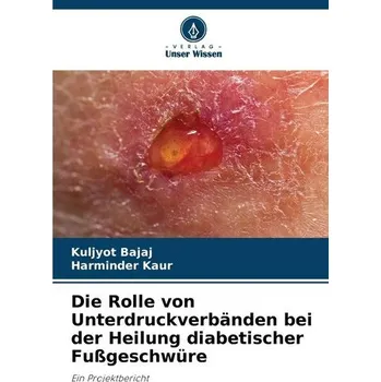 Die Rolle von Unterdruckverbänden bei der Heilung diabetischer Fußgeschwüre - Bajaj, Kuljyot