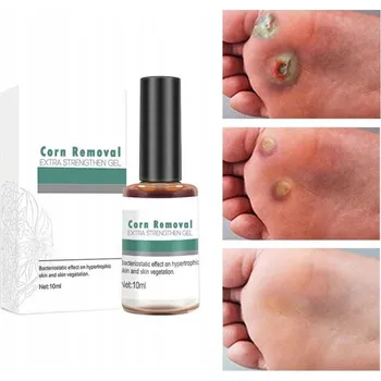 Vrták Odstranění kuřích ok a bradavic na rukou a nohou