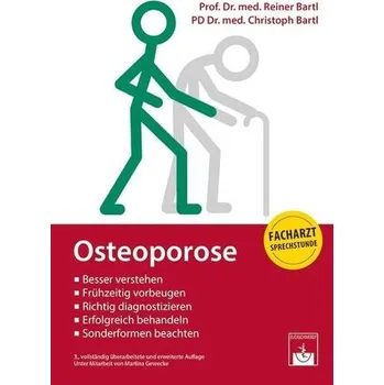 Osteoporose - Bartl, Reiner [DE] (2019, Brožovaná, Zuckschwerdt Verlag)