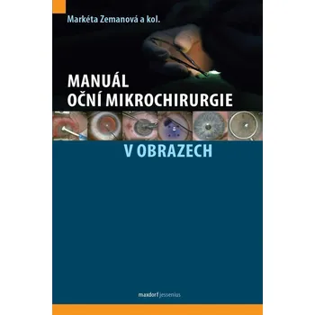 Manuál oční mikrochirurgie v obrazech