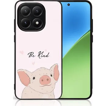 Pouzdro na tablet VSECHNONAMOBIL 131442 MY ART Ochranný kryt pro Xiaomi 15T BE KIND (190)