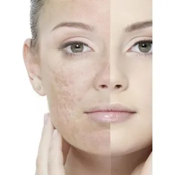 Kosmetická sada Mirra Lux ZDRAVÁ POKOŽKA BEZ AKNÉ