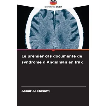 Le premier cas documenté de syndrome d'Angelman en Irak - Al Mosawi, Aamir