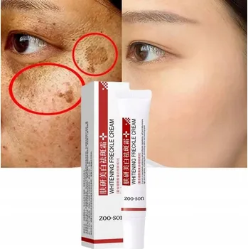 Pleťový krém Krém na Odstranění Pigmentových Skvrn, Bělící Krém
