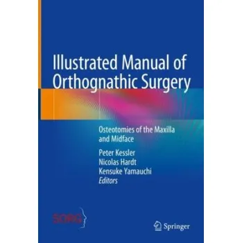 Illustrated Manual of Orthognathic Surgery: Osteotomies of the Maxilla and Midface – Peter Kessler,Nicolas Hardt,Kensuke Yamauchi (EN)