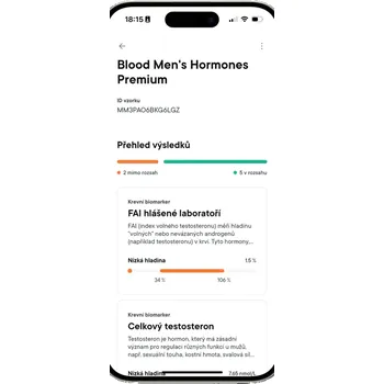 Diagnostický test MACROMO Mužské hormony Krevní test