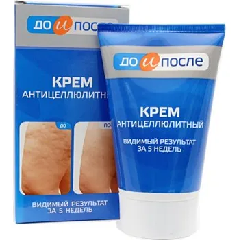 KRÉM PROTI CELULITIDĚ A ZLEPŠENÍ KREVNÍHO OBĚHU V BUŇKÁCH - PŘED A PO - 100 ML