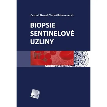 Kniha Biopsie sentinelové uzliny - Čestmír Neoral, Tomáš Bohanes