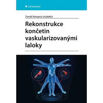 Rekonstrukce končetin vaskularizovanými laloky - kolektiv autorů, Tomáš Kempný
