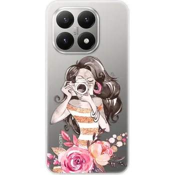 Pouzdro na mobilní telefon Odolné silikonové pouzdro iSaprio - Charming - Xiaomi 15T