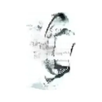 Zavěšení kol 52031509 METZGER POUZDRO RAMENE ZAVĚŠENÍ